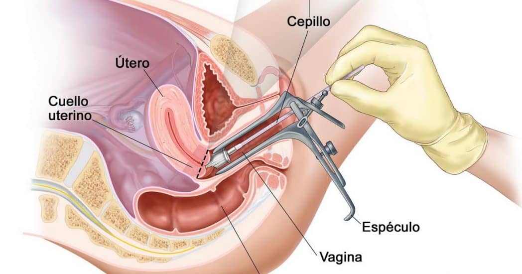 citologia cervical